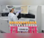 Reino Unido acusa russos de tentarem roubar informações sobre vacina contra covid