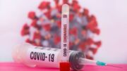 Arapongas registra 22 novos casos de coronavírus