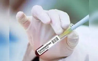 Vacina contra coronavírus da Johnson & Johnson tem testes suspensos