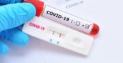 Maringá registra 3 óbitos e 102 novos casos de covid-19