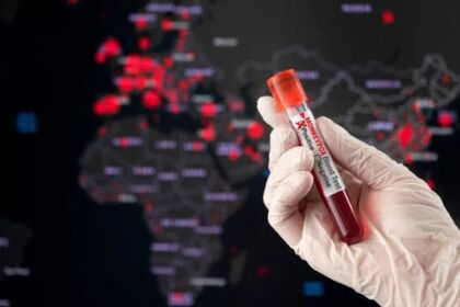 Nesta quarta-feira, foram confirmados 31 novos casos de varíola dos macacos na região