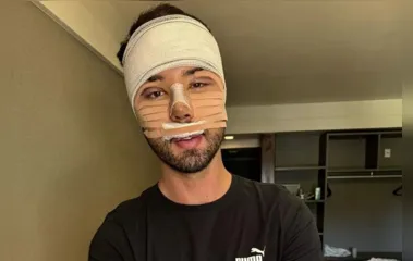 Rico Melquíades revela motivo para realizar cirurgias no rosto